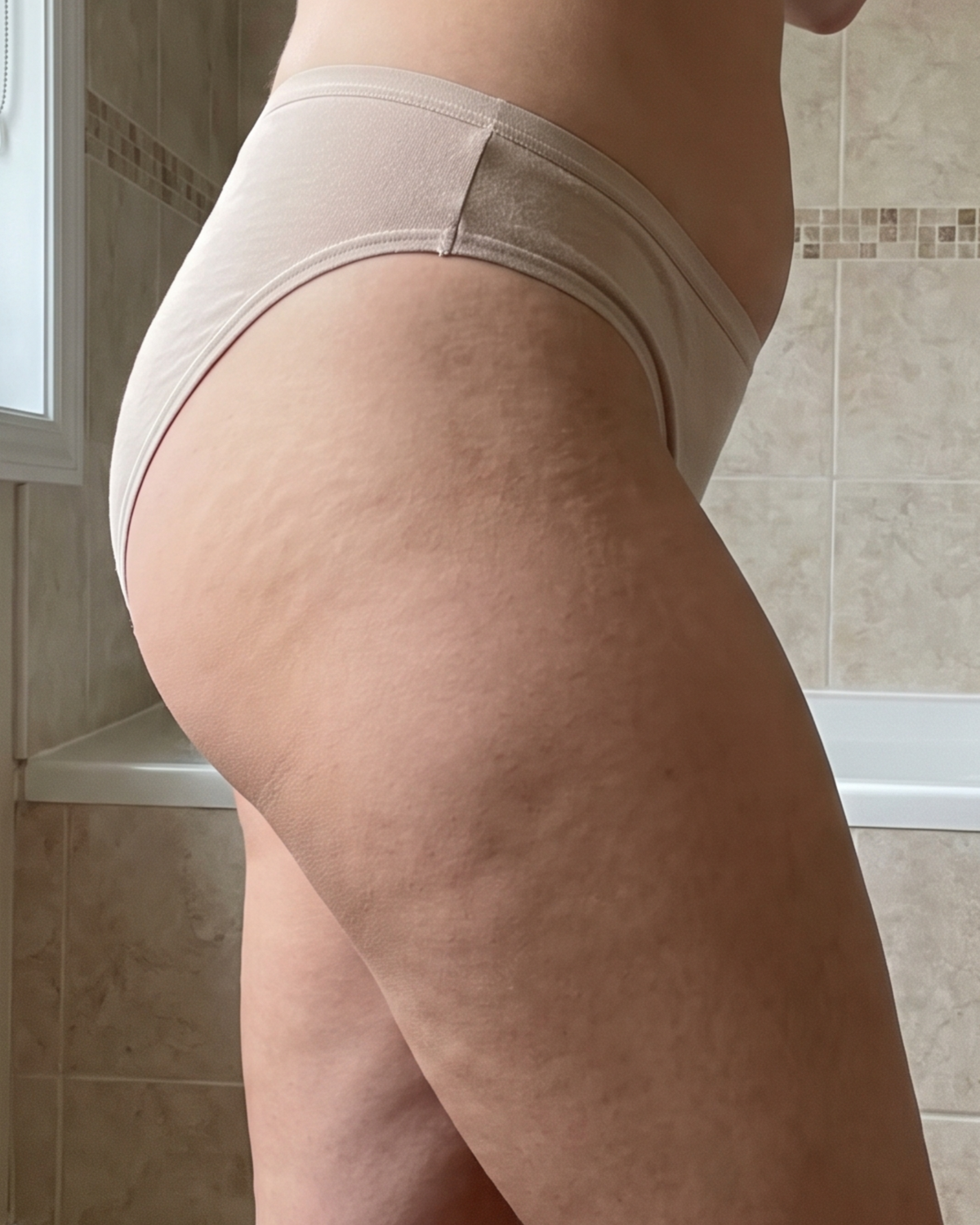 Outer thigh